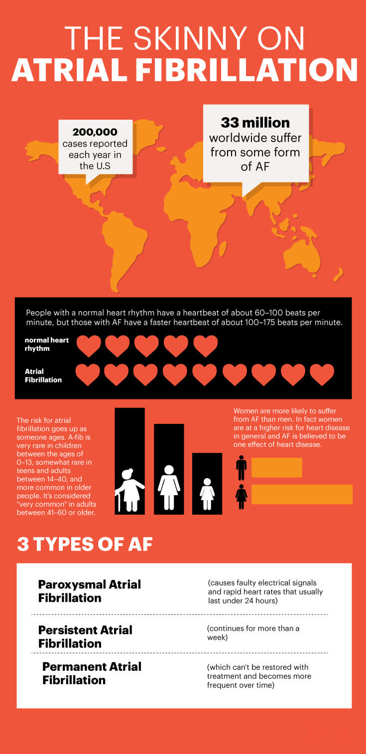 Atrial fibrillation facts MKexpressnet