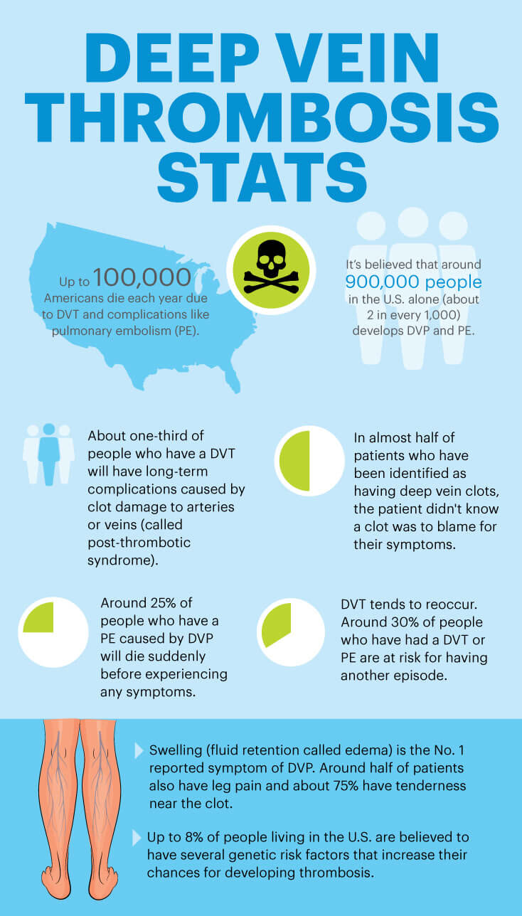 Deep vein thrombosis stats MKexpressnet